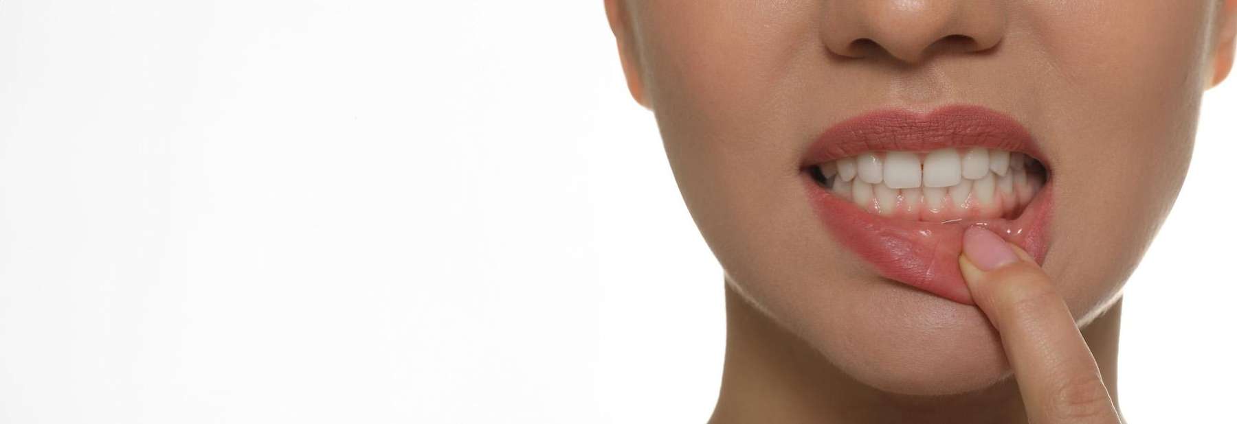 Periodontal Treatment | Dentist